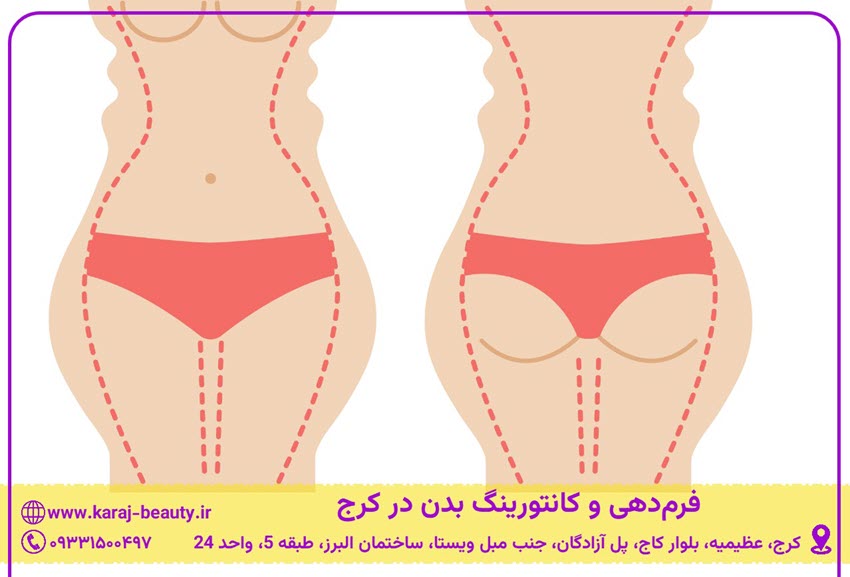 کانتورینگ بدن در کرج چیست؟ | کلینیک آنسه عظیمیه کرج