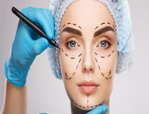 زاویه سازی صورت چند سی سی ژل لازم دارد؟ بهترین دکتر زاویه سازی صورت در کرج