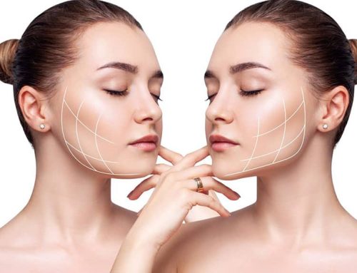 مراقبت های بعد از زاویه سازی فک چیست؟ مرکز زاویه سازی صورت در کرج