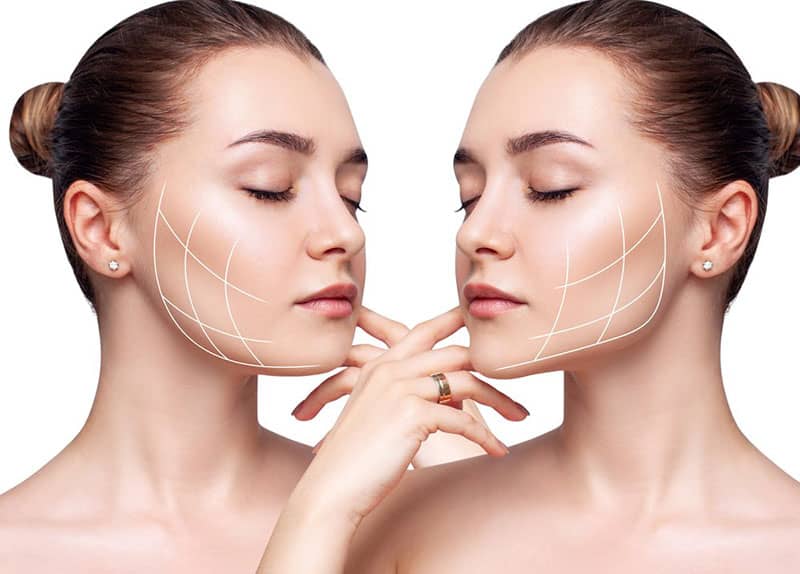مراقبت های بعد از زاویه سازی فک چیست؟ مرکز زاویه سازی صورت در کرج