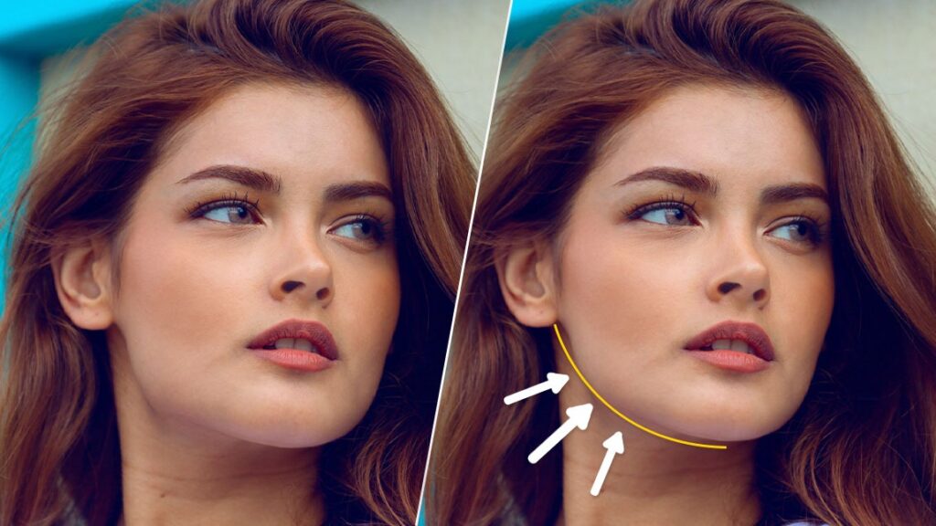 مراقبت های بعد از زاویه سازی فک چیست؟ مرکز زاویه سازی صورت در کرج