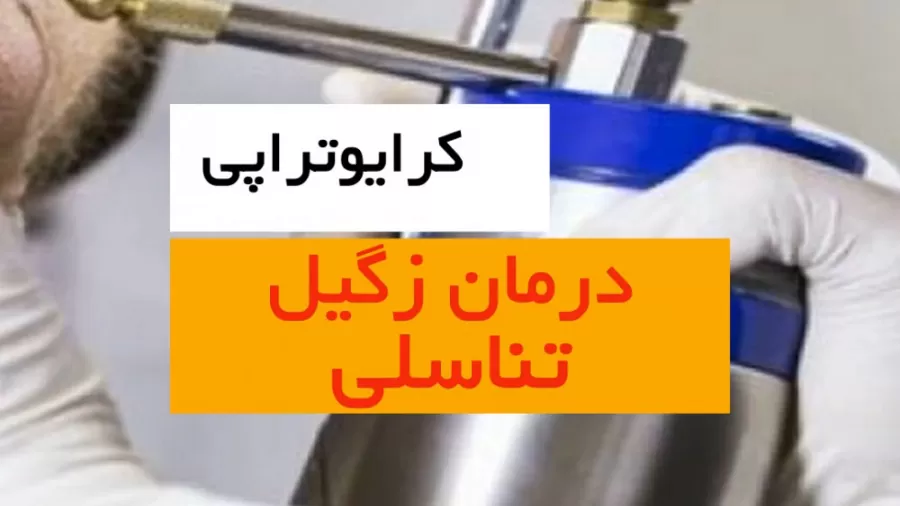 کرایوتراپی زگیل تناسلی در کرج