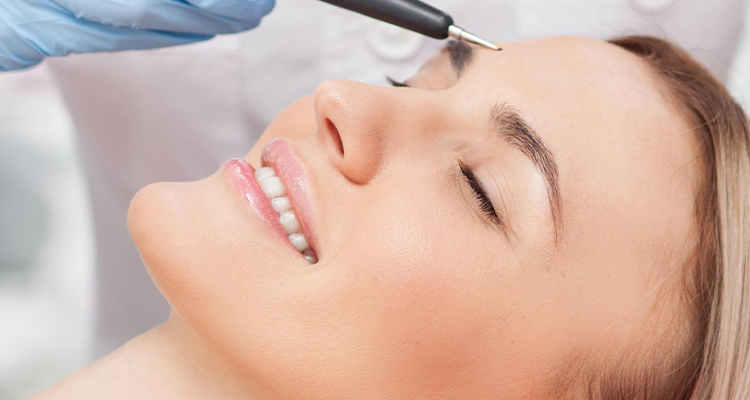 الکترولیز موهای سفید در کرج