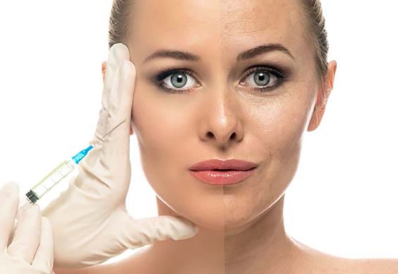 دکتر خوب برای تزریق چربی صورت در کرج