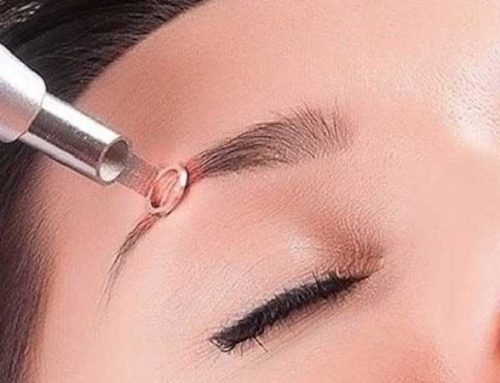 مرکز تخصصی پاک کردن تاتو ابرو در کرج