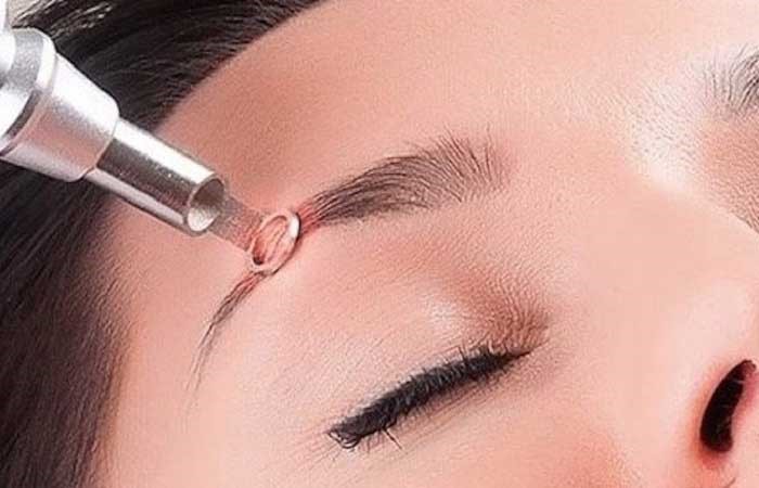 مرکز تخصصی پاک کردن تاتو ابرو در کرج