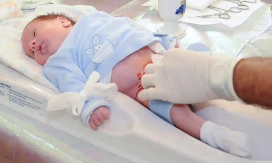 دکتر ختنه در کرج