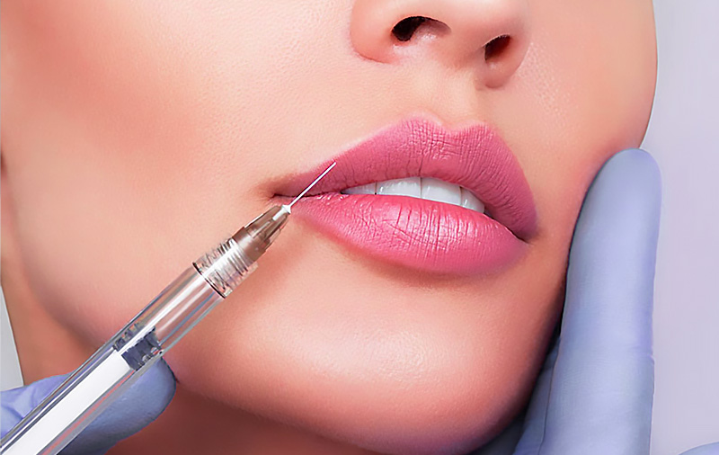 تزریق ژل لب در کرج
