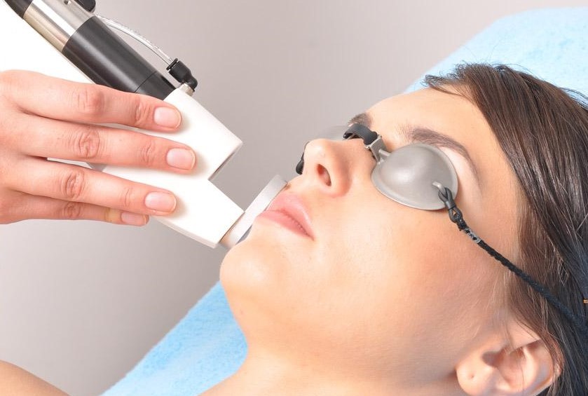 هزینه لیزر موهای سفید صورت در کرج