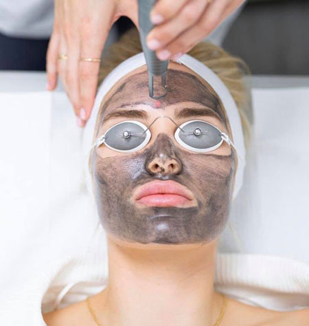 لایه برداری کربن در کرج