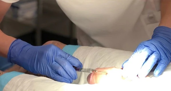 تزریق ژل به اندام تناسلی مردان در کرج