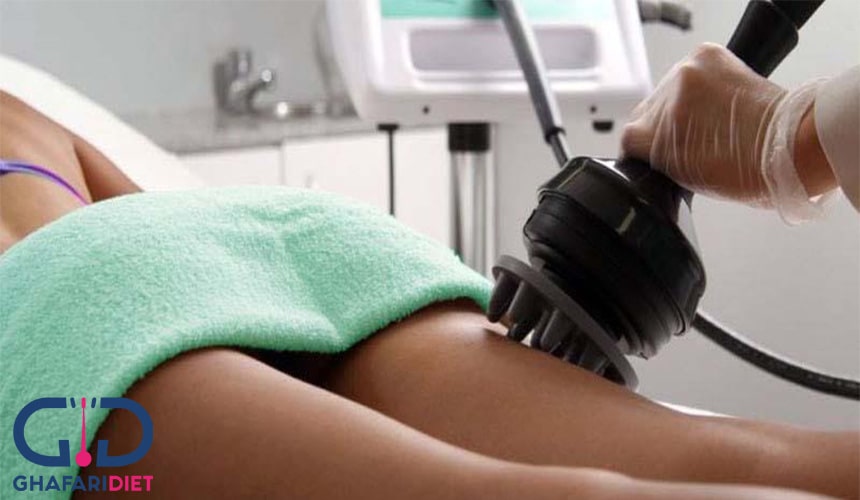 مزایای لاغری موضعی با دستگاه