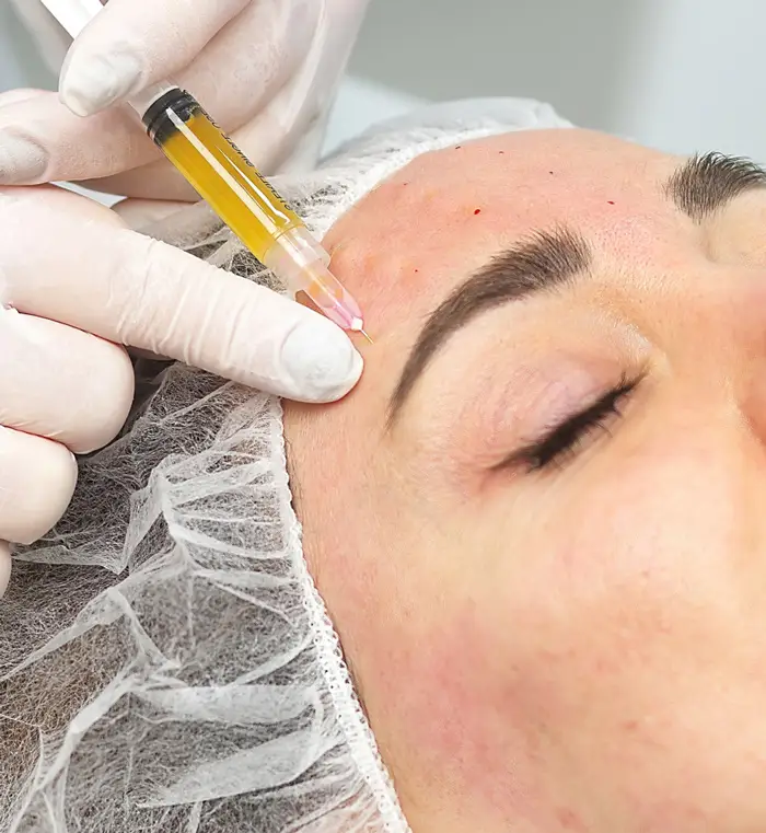 پی آر پی چه عوارضی دارد؟