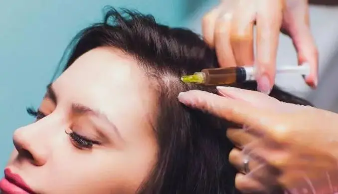 کاشت مو برای زنان موثر است؟