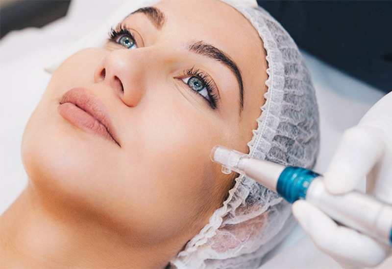 درمان لک ایجاد شده بعد از میکرونیدلینگ