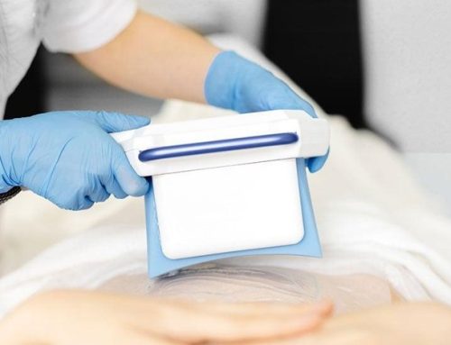 لاغری با دستگاه کرایو لیپولیز در کرج