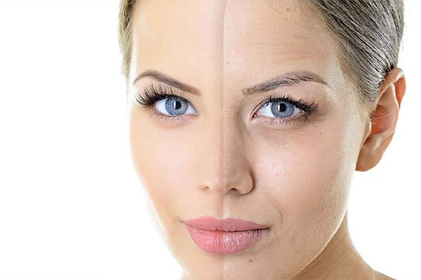 پی آر پی صورت چقدر برای جوانسازی موثر است؟ بررسی پی آر پی صورت برای جوانسازی