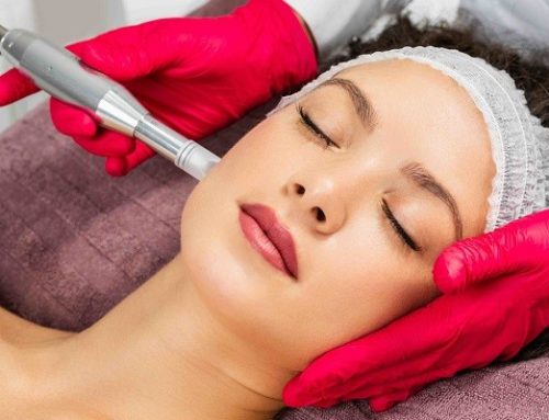 میکرونیدلینگ چقدر برای جای جوش موثر است؟