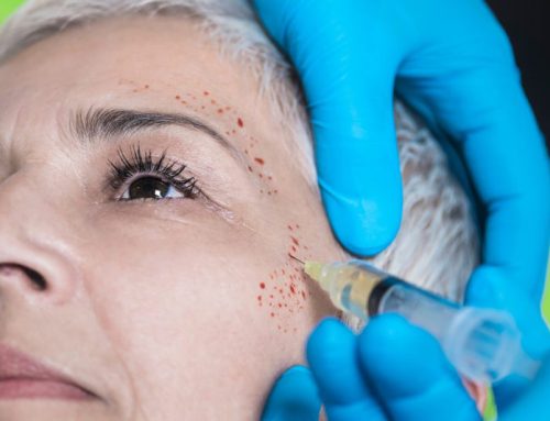 پی آر پی صورت چقدر برای جوانسازی موثر است؟