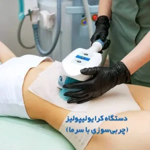 لاغری با دستگاه کرایولیپولیز