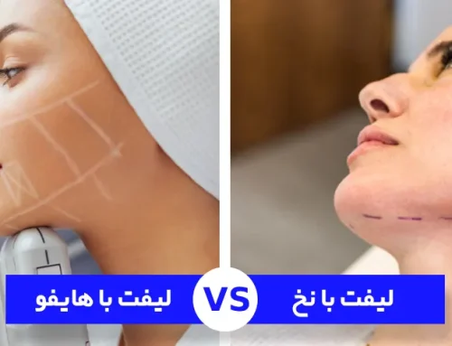 لیفت صورت با نخ بهتره یا هایفوتراپی؟ | مقایسه کامل