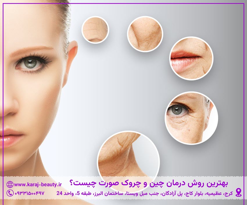 بهترین روش درمان چین و چروک صورت چیست؟ | کلینیک آنسه