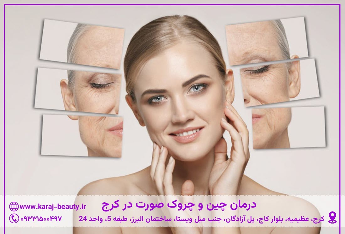 درمان چین و چروک صورت در کرج | کلینیک آنسه