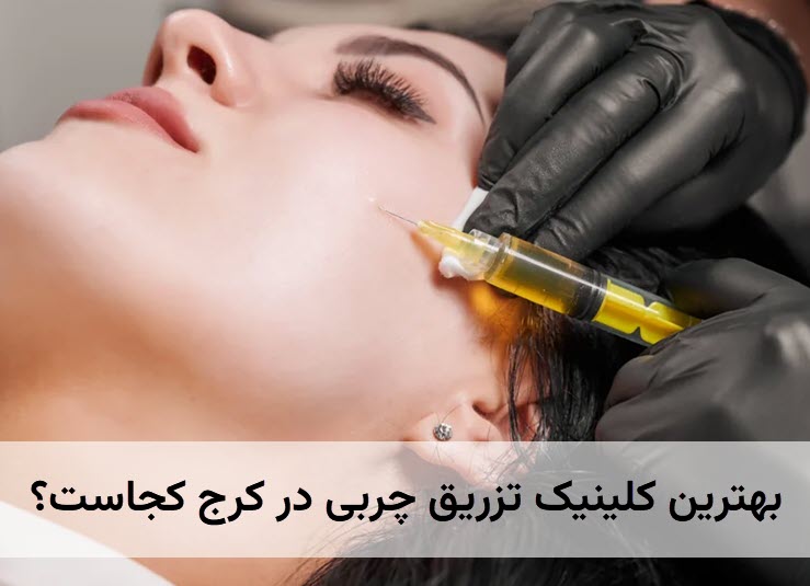 بهترین کلینیک تزریق چربی در کرج کجاست | کلینک زیبایی آنسه در عظیمیه کرج