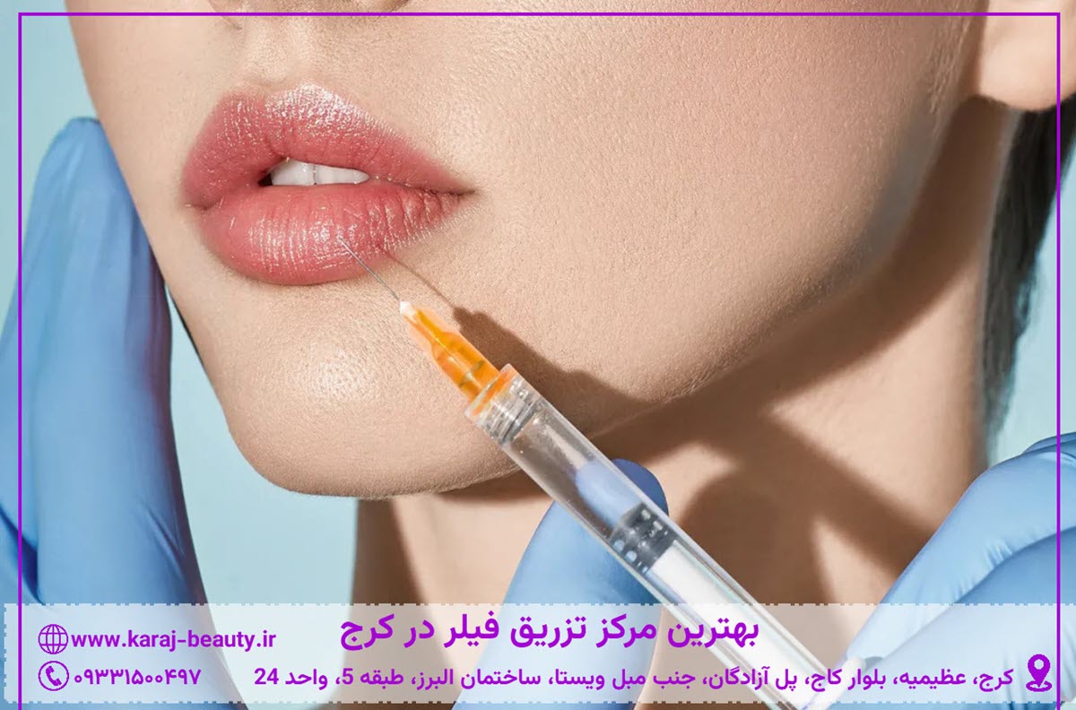 بهترین مرکز تزریق فیلر در کرج | فیلر لب، گونه و زاویه فک| کلینیک آنسه