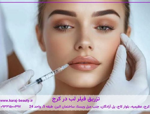 تزریق فیلر لب در کرج💉هزینه، ماندگاری و مراقبت‌های بعد از تزریق
