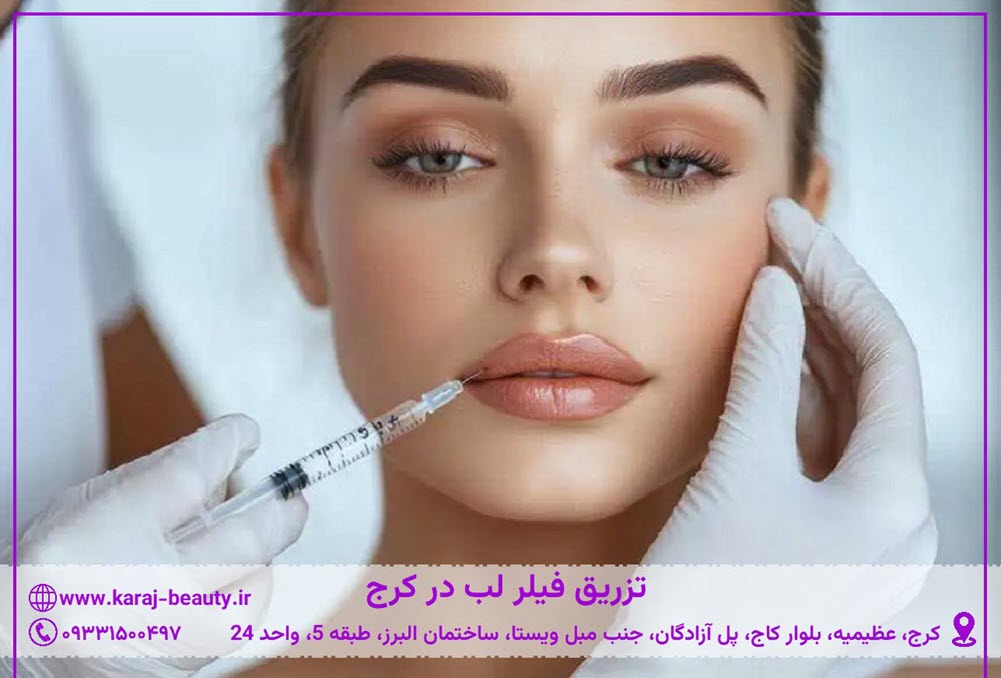 تزریق فیلر لب در کرج | کلینیک زیبایی آنسه کرج