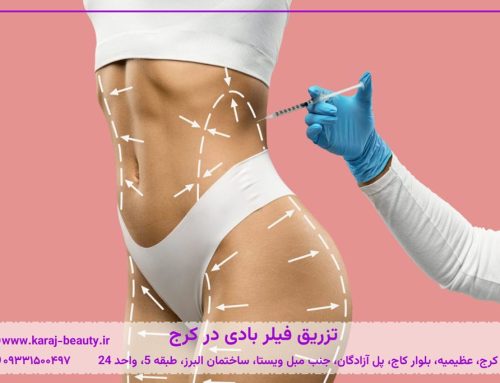 تزریق فیلر بادی در کرج | فرم‌دهی و حجم‌دهی بدن