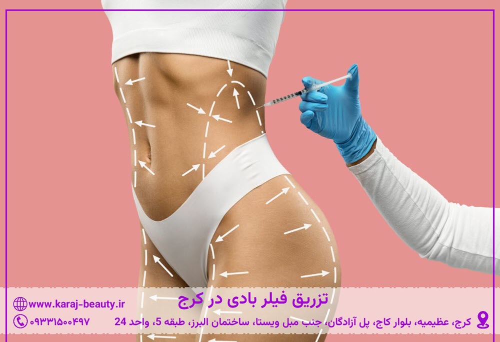 تزریق فیلر بادی در کرج | کلینیک زیبایی آنسه