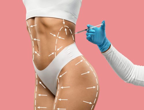 تزریق فیلر بادی در کرج | فرم‌دهی و حجم‌دهی بدن