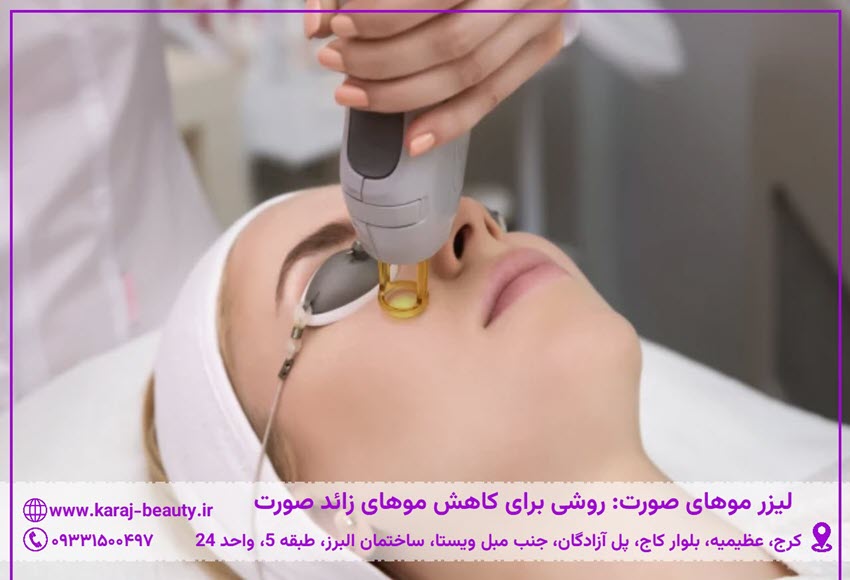 لیزر موهای صورت در کلینیک زیبایی آنسه در آزادگان