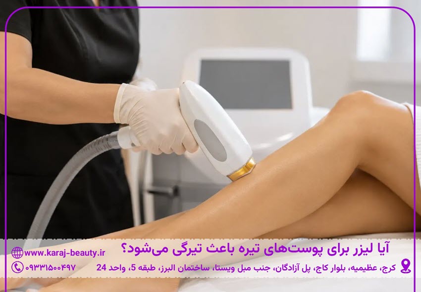 آیا لیزر برای پوستهای تیره باعث تیرگی میشود؟ | کلینیک زیبایی آنسه