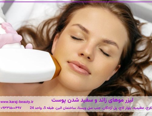 آیا لیزر موهای زائد باعث روشن شدن پوست میشود؟ بررسی تأثیر لیزر بر تیرگی پوست