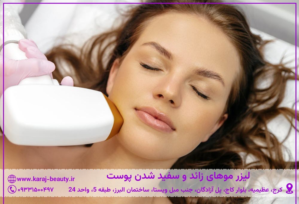 آیا لیزر موهای زائد باعث روشن شدن پوست میشود؟ | کلینیک آنسه