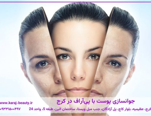 پی آر اف صورت در کرج – هزینه، فواید، مراحل انجام و انتخاب مرکز مناسب