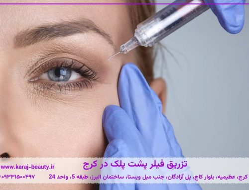 تزریق فیلر پشت پلک در کرج👁️هزینه، مزایا، عوارض و فیلر پلک بالا