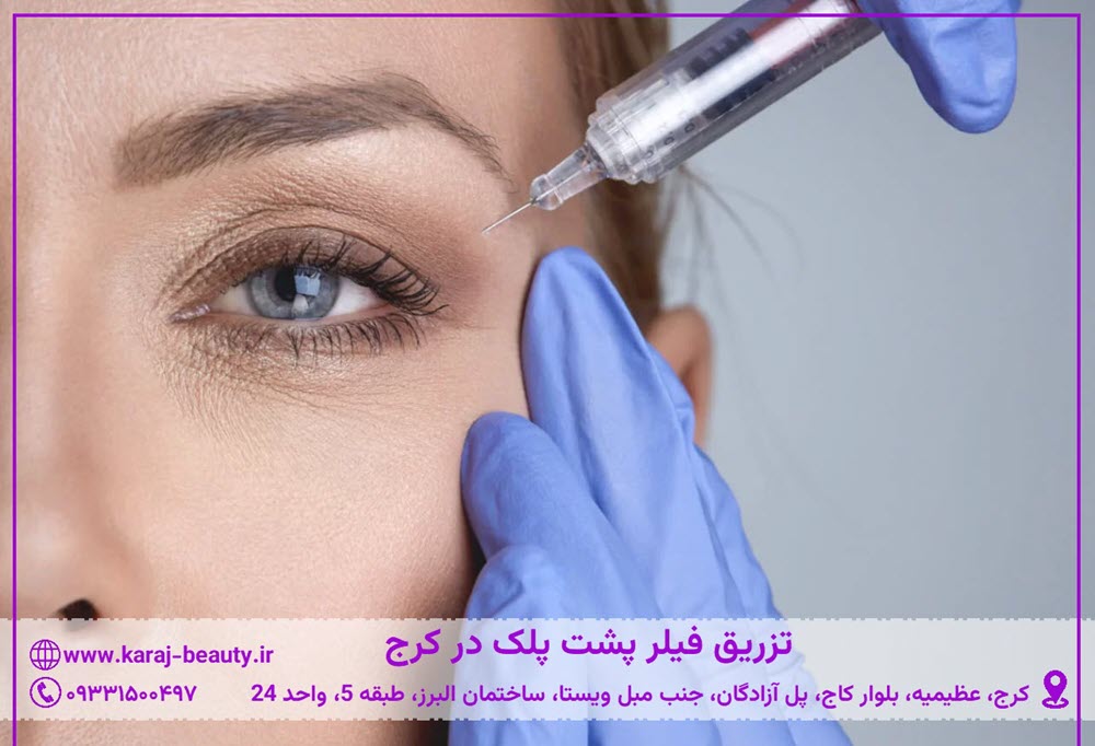 تزریق فیلر پشت پلک در کرج | کلینیک زیبایی آنسه