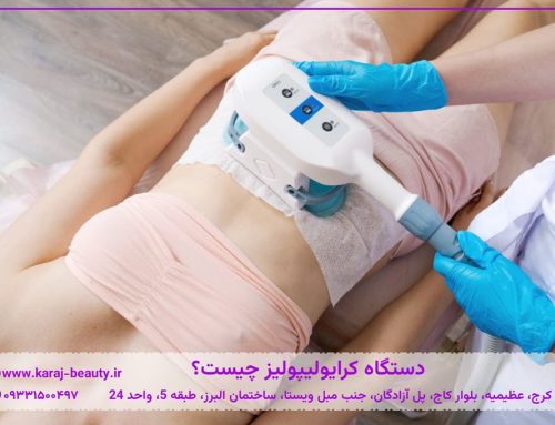 کرایولیپولیز چیست؟ بررسی لاغری با دستگاه، هزینه، عوارض و نتیجه درمان