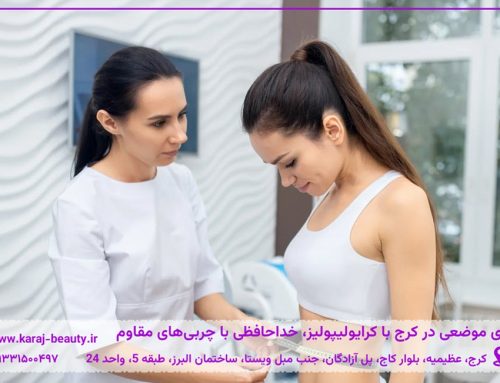 بهترین روش لاغری موضعی در کرج چیست؟ بررسی کرایولیپولیز