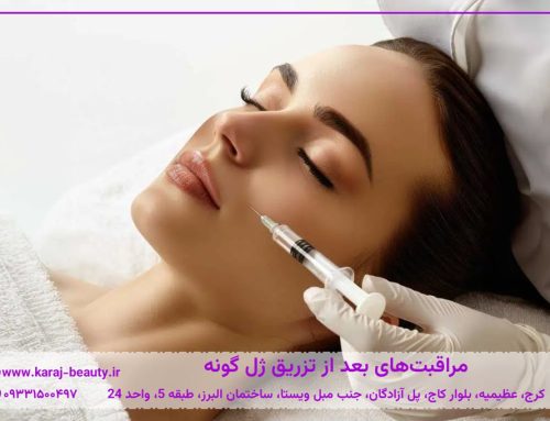 مراقبت‌های بعد از تزریق ژل گونه | کاهش ورم و ماندگاری بیشتر فیلر