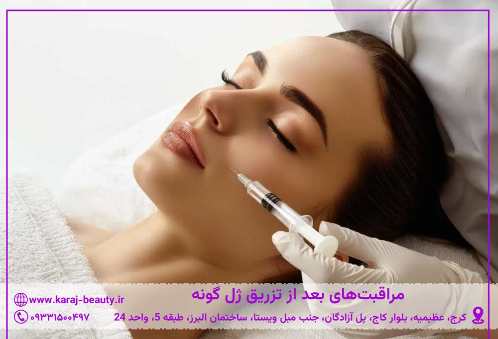 مراقبت بعد از تزریق ژل گونه | کلینیک زیبایی آنسه در آزادگان کرج