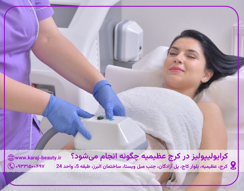 کرایولیپولیز در کرج عظیمیه چگونه انجام می‌شود؟ | کلینیک زیبایی آنسه در عظیمیه کرج
