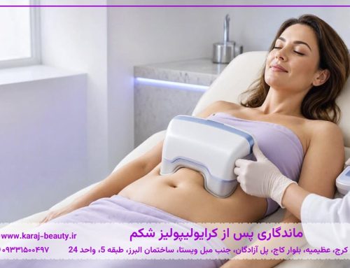 آیا چربی شکم بعد از کرایولیپولیز برمی‌گردد؟ ماندگاری و راه‌های حفظ نتیجه