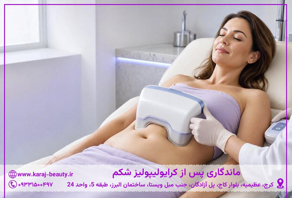 چربی شکم بعد از کرایولیپولیز | کلینیک زیبایی آنسه در آزادگان کرج