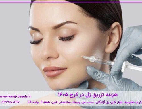 هزینه تزریق ژل در کرج ۱۴۰۵❤️ قیمت فیلر لب، گونه و صورت