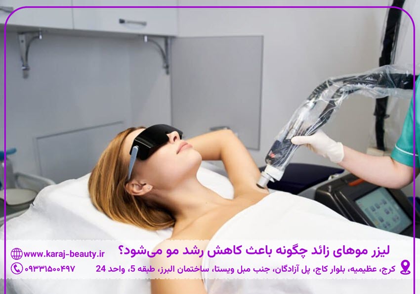 لیزر موهای زائد چگونه باعث کاهش رشد مو میشود؟ | کلینیک زیبایی آنسه در آزادگان کرج